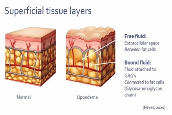 Centro specializzato nel trattamento del Lipedema